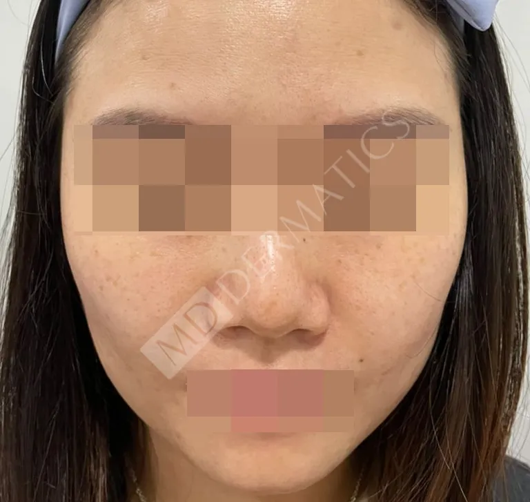 Before After Case Study 4