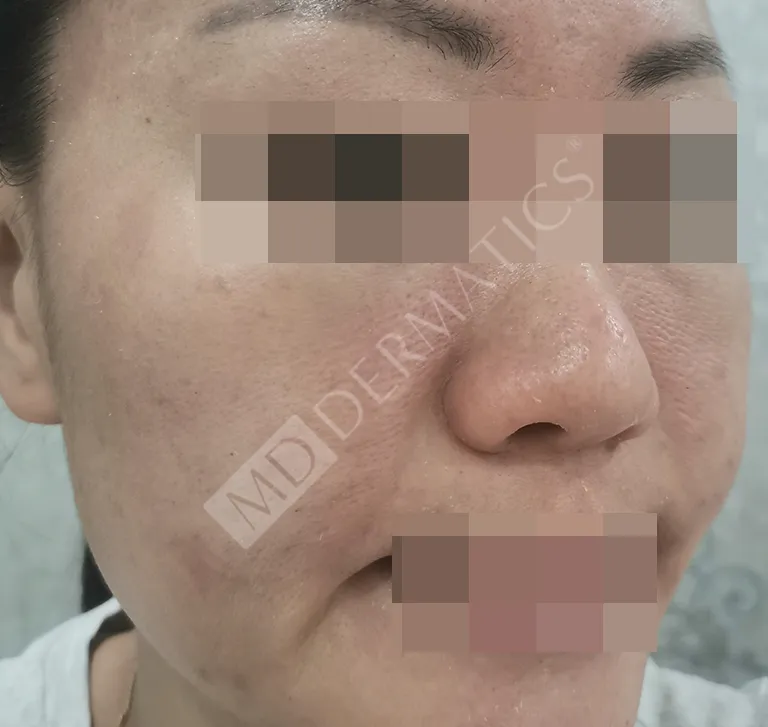 Before After Case Study 7