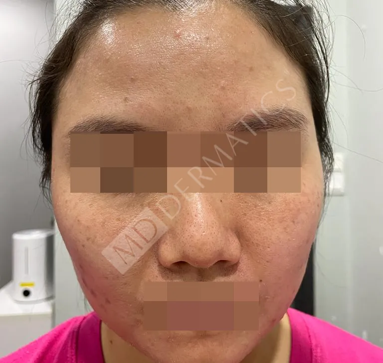 Before After Case Study 4