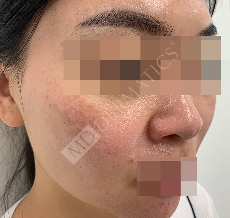 Before After Case Study 5