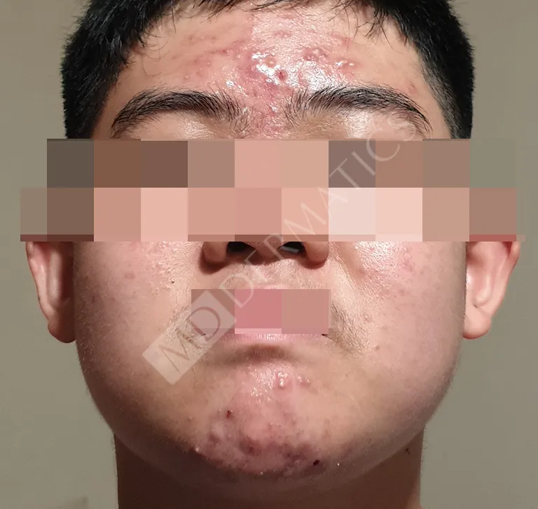 Before After Case Study 6