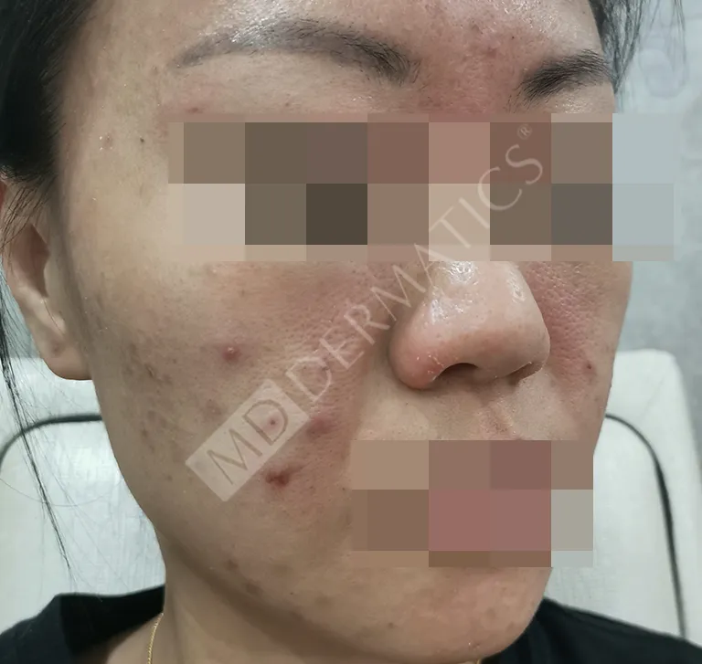 Before After Case Study 6